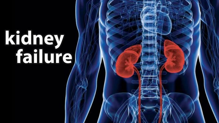 kidney-failure